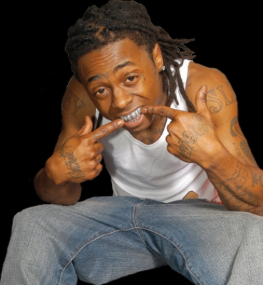 Lil Wayne reportedly also had several tooth implants 